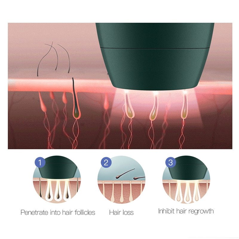 Home Laser Hair Removal Device-Professional , Safe , and Long-Lasting Results