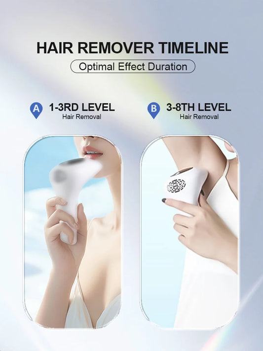 ProSkin™ IPL Hair Removal Device – Permanent Laser Depilator for Full Body