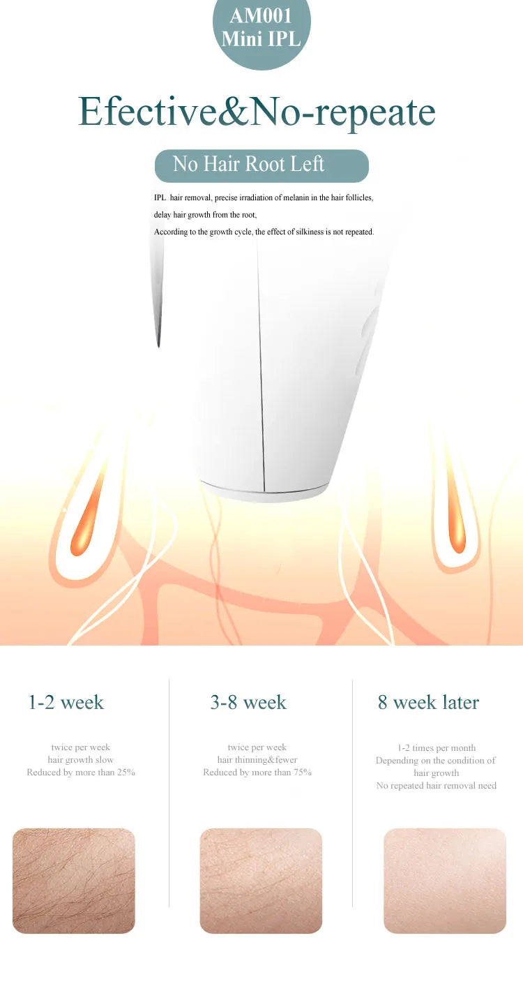 ProSkin™ IPL Hair Removal Device – Permanent Laser Depilator for Full Body